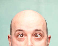 Bald-Head-Crossed-Eyed Man